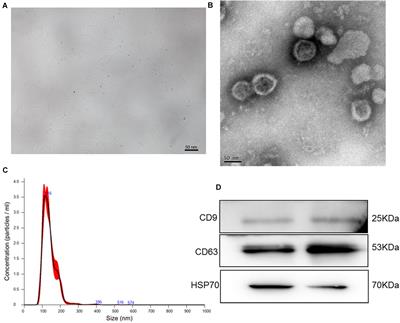 Exosomes Isolated From Bone Marrow Mesenchymal Stem Cells Exert a Protective Effect on Osteoarthritis via lncRNA LYRM4-AS1-GRPR-miR-6515-5p